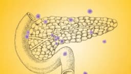 7 señales silenciosas del cáncer de páncreas que casi nadie nota