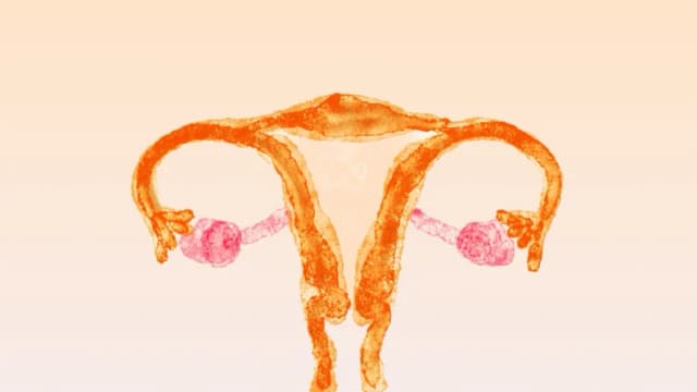 SOP: Una de las afecciones femeninas más incomprendidas ahora cambia de nombre
