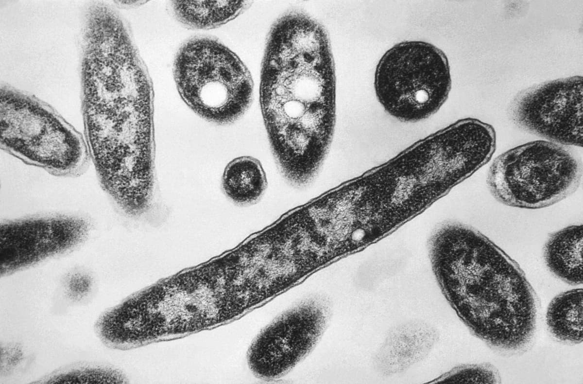 La bacteria Legionella pneumophila, responsable de causar la enfermedad pulmonar conocida como legionelosis, en una imagen tomada con microscopio electrónico en 1978. (Francis Chandler/CDC vía AP)