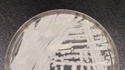 CDC reportan casos de hongo potencialmente mortal en 27 estados en lo que va del año