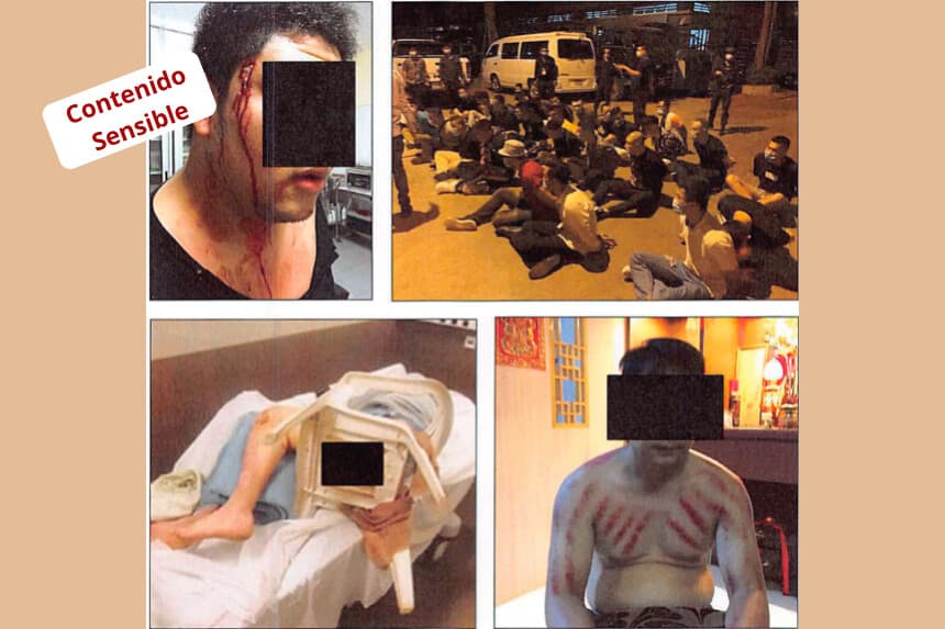 Las fotografías incluidas en los documentos judiciales muestran la violencia infligida a los trabajadores en los centros de estafa. (Departamento de Justicia de los Estados Unidos).