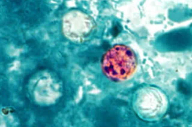 Ooquistes de Cyclospora cayetanensis en una muestra de heces (imagen de archivo). (CDC vía The Epoch Times).