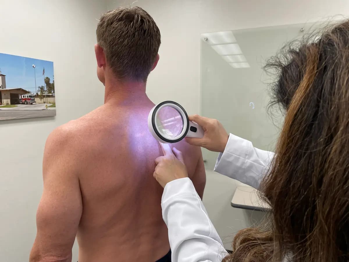 <em>Un médico realiza una revisión para detectar cáncer de piel a un bombero en Huntington Beach, California, el 30 de abril de 2023. (Sophie Li/The Epoch Times).</em>