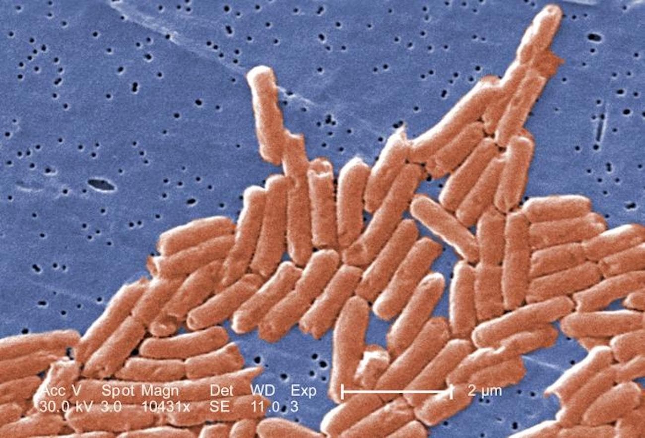 Imagen de microscopía electrónica de barrido coloreada digitalmente de un grupo de bacilos Gram negativos, o bacterias Salmonella sp. con forma de bastón. (Janice Haney Carr/CDC).
