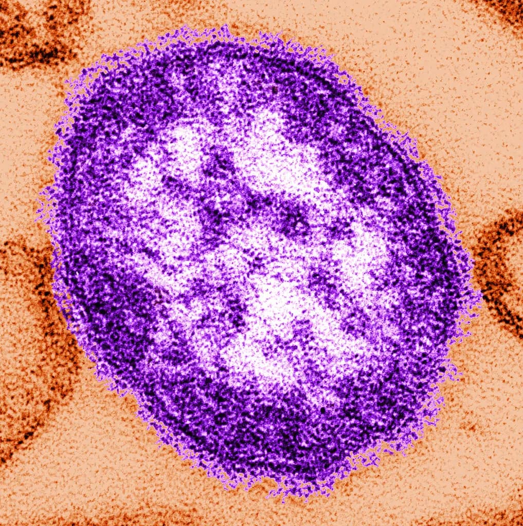 Una micrografía electrónica de transmisión (TEM) de sección delgada revela el aspecto ultraestructural de una única partícula viral, o "virión", del virus del sarampión. (CDC a través de Getty Images).