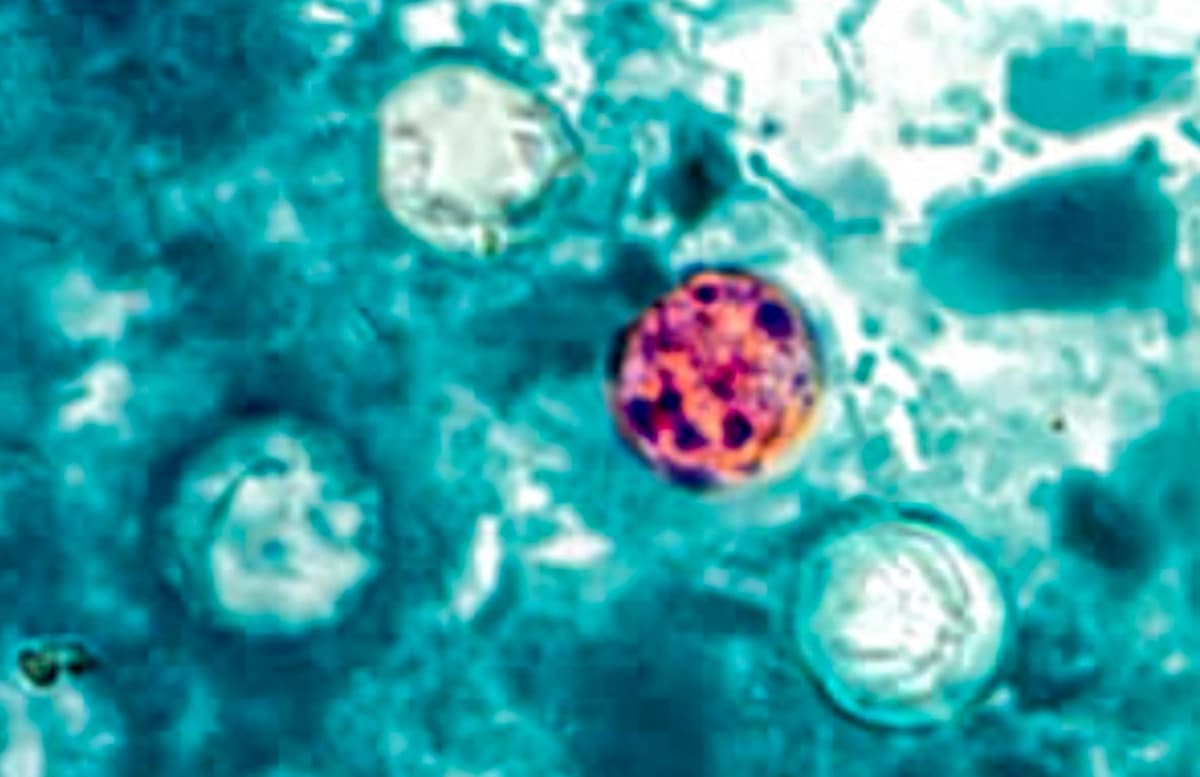 Oocistos de Cyclospora cayetanensis en una muestra de heces en una imagen de archivo. (CDC vía The Epoch Times)