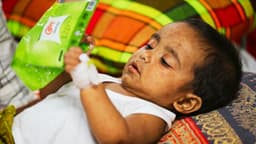 Bangladés enfrenta el mayor brote activo de sarampión con más de 200,000 casos sospechosos