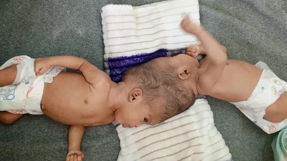 <em>Hospital Infantil SSM Health Cardinal Glennon.</em>