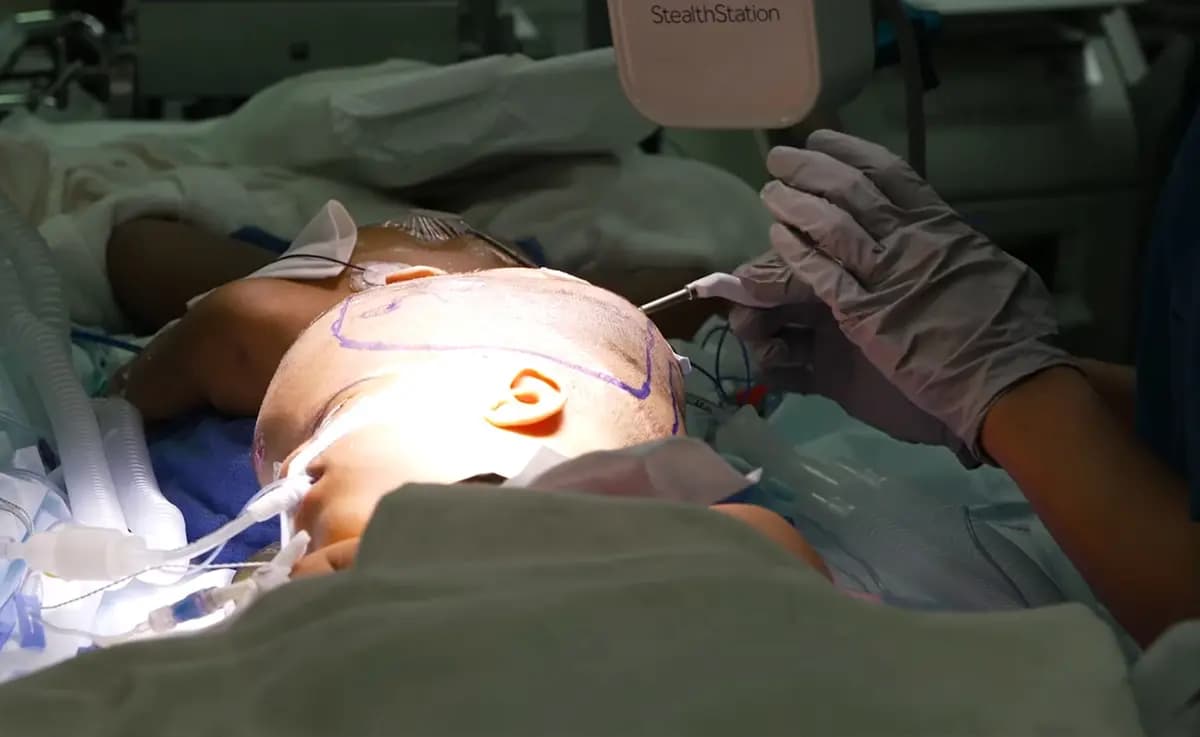 <em>Miembros de un equipo médico multidisciplinario de 60 personas preparan el quirófano el 24 de febrero de 2026, momentos antes de comenzar el procedimiento de separación final. (Hospital Infantil SSM Health Cardinal Glennon).</em>