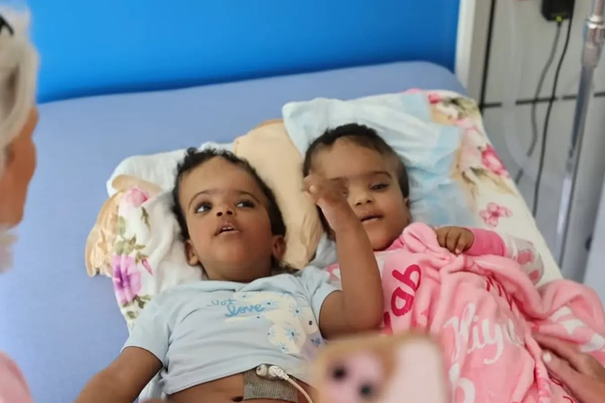 <em>Hiyab y Wuhbto yacen una al lado de la otra durante una visita postoperatoria tras su histórica separación craneal. (Hospital Infantil SSM Health Cardinal Glennon).</em>