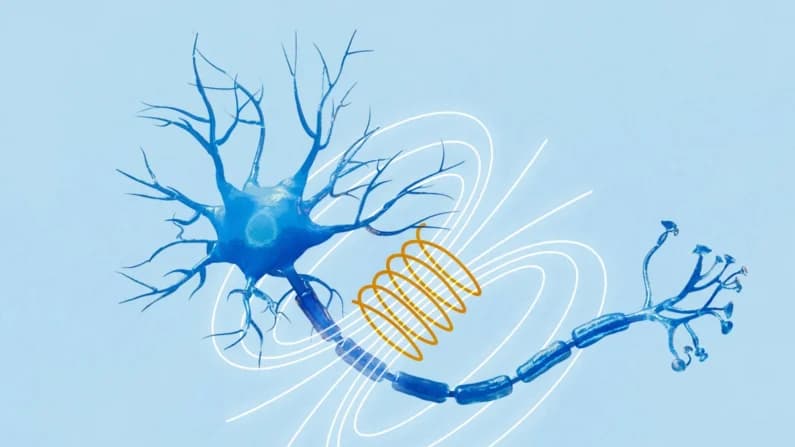 Campos electromagnéticos podría combatir el Parkinson en etapas tempranas