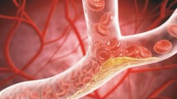 Más allá del colesterol: cambios ocultos en la salud del corazón