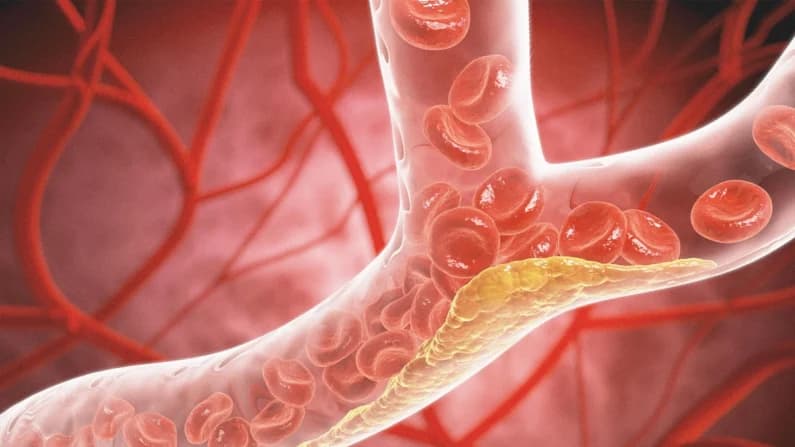 Más allá del colesterol: cambios ocultos en la salud del corazón