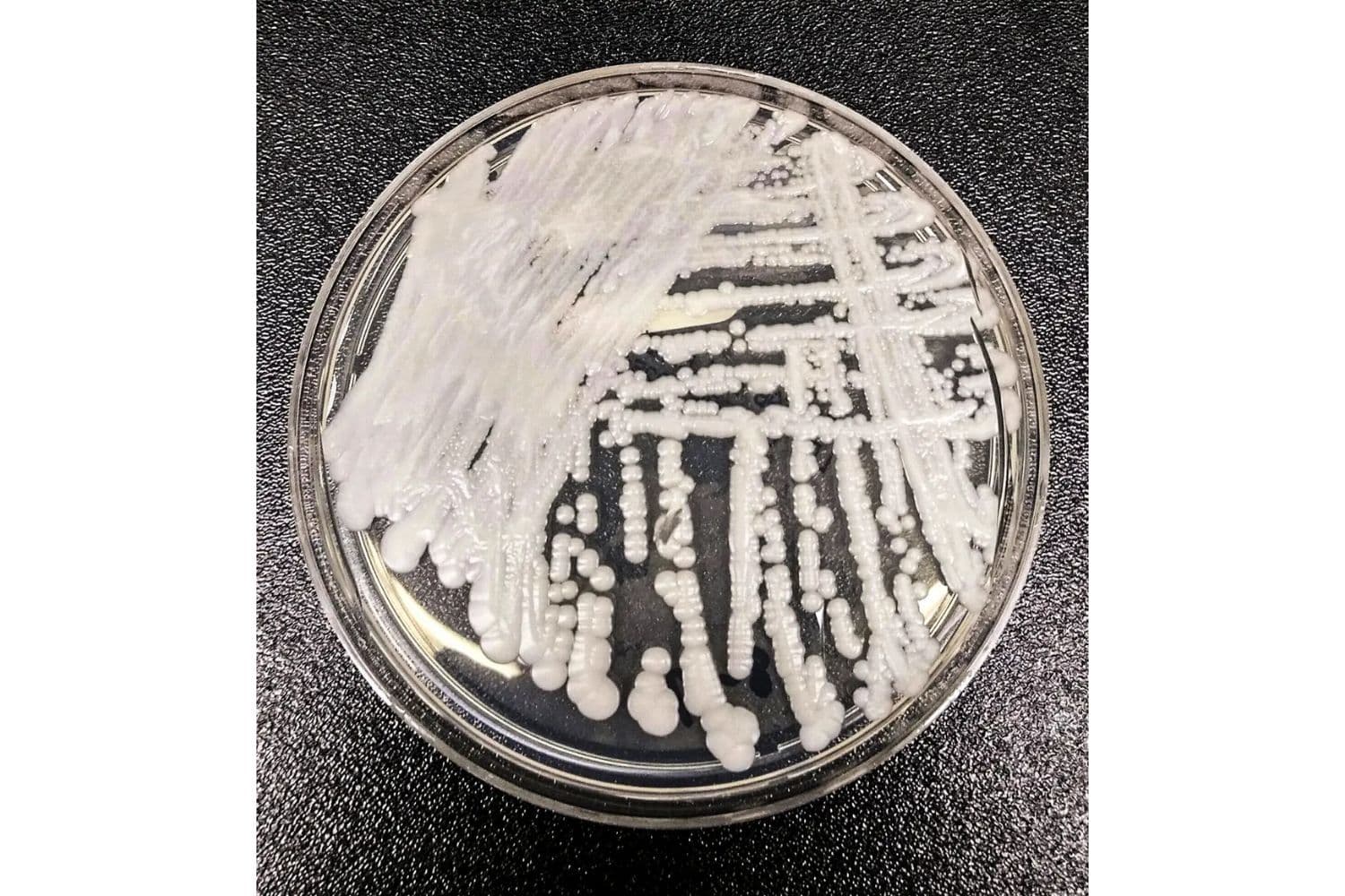 Esta foto sin fecha, proporcionada por los Centros para el Control y la Prevención de Enfermedades (CDC), muestra una cepa de Candida auris cultivada en una placa de Petri en un laboratorio de los CDC. (The Canadian Press/Shawn Lockhart-CDC vía AP)