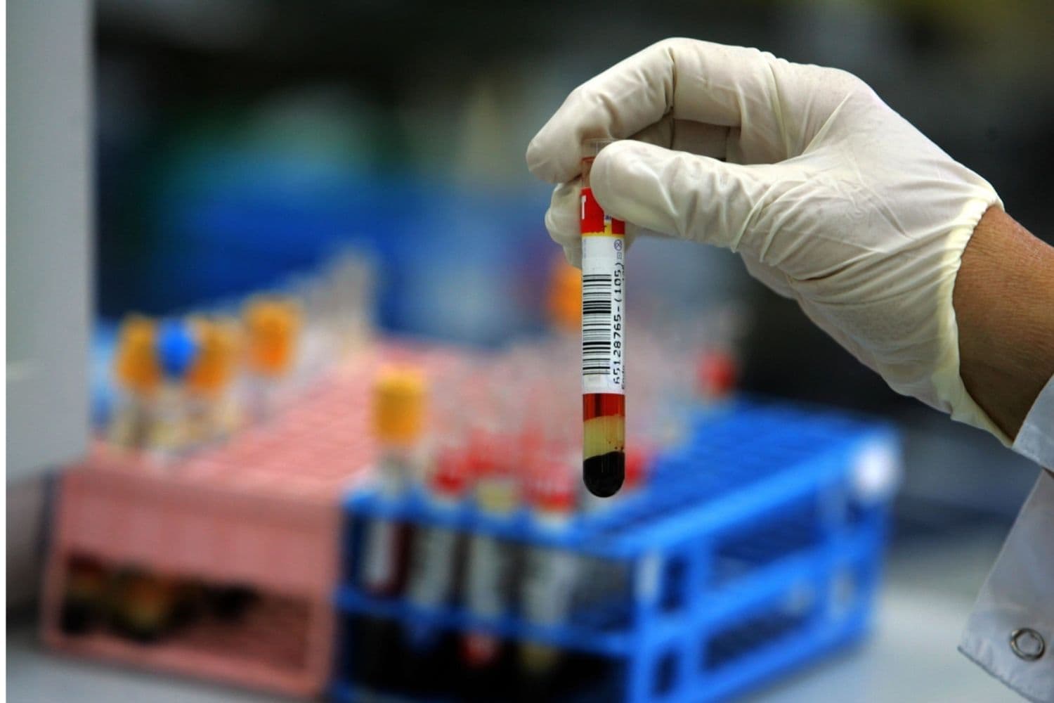 Un técnico de laboratorio toma un tubo de ensayo con una muestra de sangre humana. (David Silverman/Getty Images)