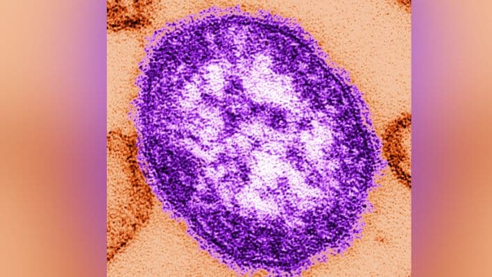 SIN FECHA: En este folleto de los Centros para el Control y la Prevención de Enfermedades (CDC), una micrografía electrónica de transmisión (TEM) de sección delgada revela el aspecto ultraestructural de una sola partícula de virus, o «virión», del virus del sarampión. en esta imagen sin fecha. (Foto de los CDC a través de Getty Images)