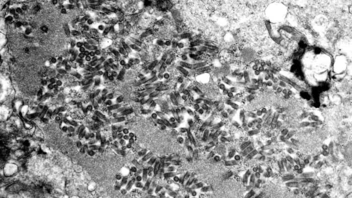 Una imagen de microscopio electrónico muestra viriones de la rabia, oscuros y con forma de bala, dentro de una muestra de tejido infectado. (FA Murphy/CDC vía AP)