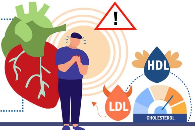 Más allá del colesterol se encuentra un nuevo enfoque para la salud del corazón