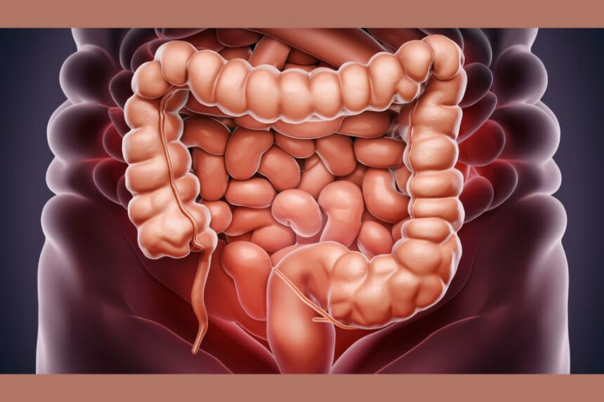 Iniciativa de detección precoz reduce 50 % el cáncer colorrectal y las muertes por la enfermedad