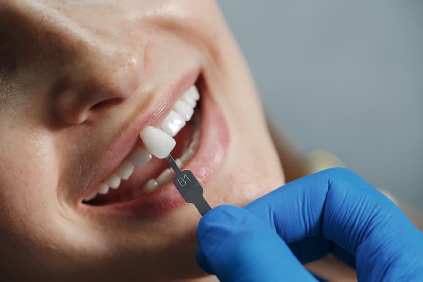 No sustituir un diente perdido a tiempo puede provocar una mala alineación dental, enfermedad periodontal o una mordida incorrecta.(Imagen de Holiak en Freepik)