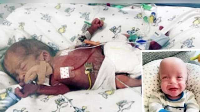 Le dieron 1% de vida pero no abortó: "Si me hubiera guiado por los médicos, lo habría aniquilado"