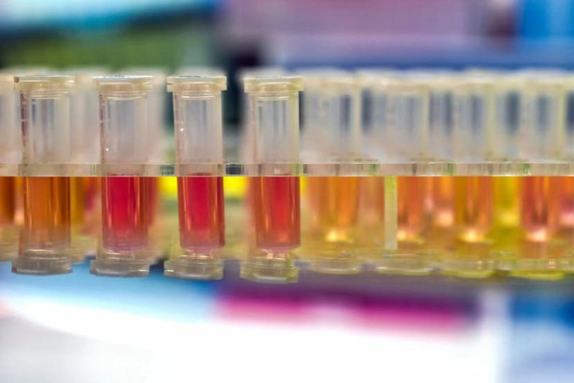 Muestras de personas que serán sometidas a pruebas para detectar el nuevo coronavirus en un laboratorio de Wuhan, China. (STR/AFP a través de Getty Images)