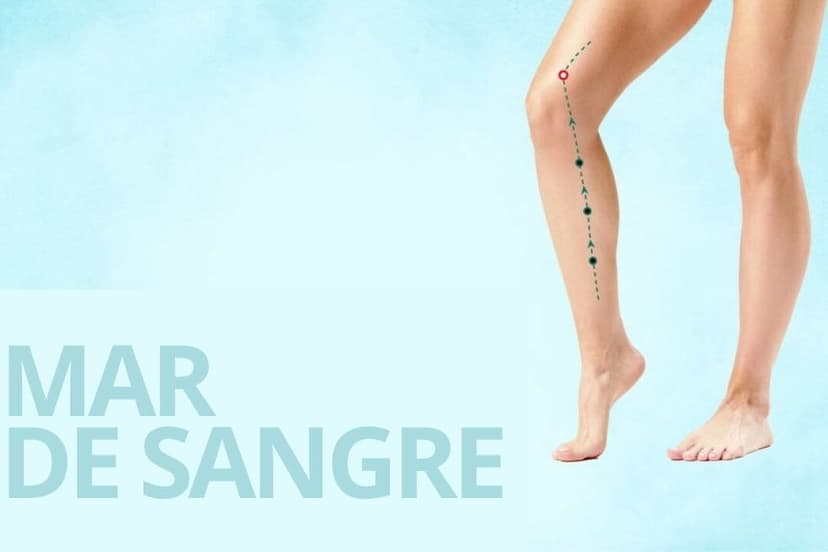 SP10 Mar de sangre Xue Hai