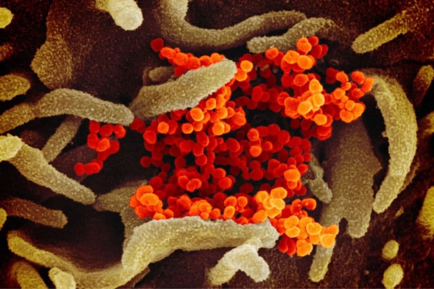Esta imagen de microscopio electrónico de barrido muestra el nuevo coronavirus (naranja), causante de la enfermedad COVID-19, aislado de un paciente en EE. UU., emergiendo de la superficie de células (verde) cultivadas en el laboratorio. (Foto publicada el 13 de febrero de 2020. NIAID-RML)