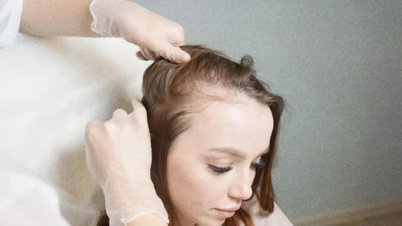 Lo que su cabello podría revelar sobre su salud