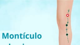 Utilice este punto de acupuntura para apoyar su estómago en crisis