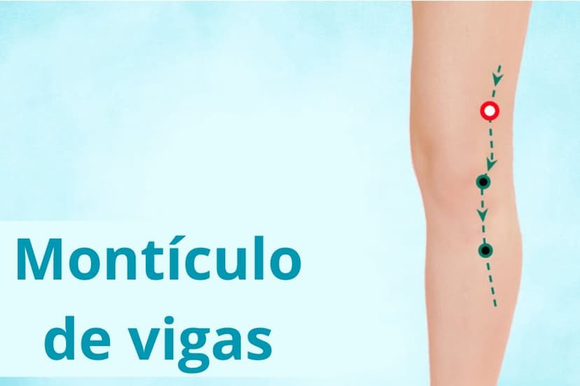 (Montículo de vigas ST34 Liang Qiu)