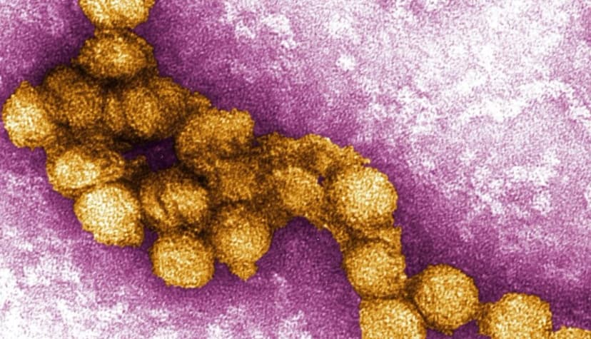 Micrografía del virus del Nilo Occidental en una fotografía de 2014. (Cynthia Goldsmith, PE Rollin, Centros para el Control y la Prevención de Enfermedades de EE. UU .)