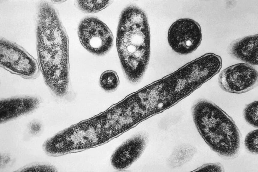 Bacterias Legionella pneumophila, responsables de causar la enfermedad neumónica conocida como legionelosis, en una imagen tomada con un microscopio electrónico en 1978. (Francis Chandler/CDC vía AP).
