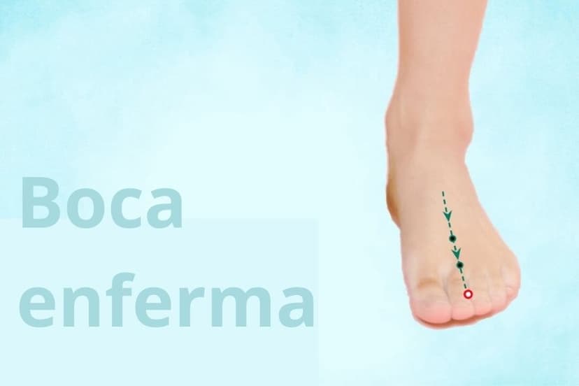 ST45 Boca enferma (Li Dui) (The Epoch Times)