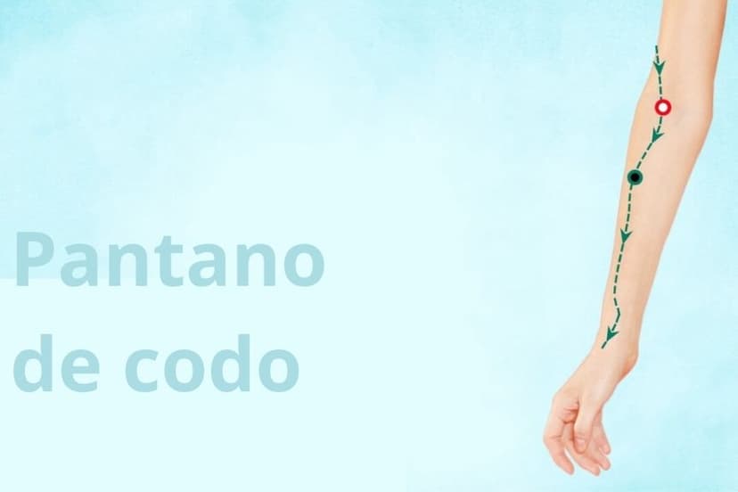 LU5 Cubit Marsh (Chi Ze) (The Epoch Times)