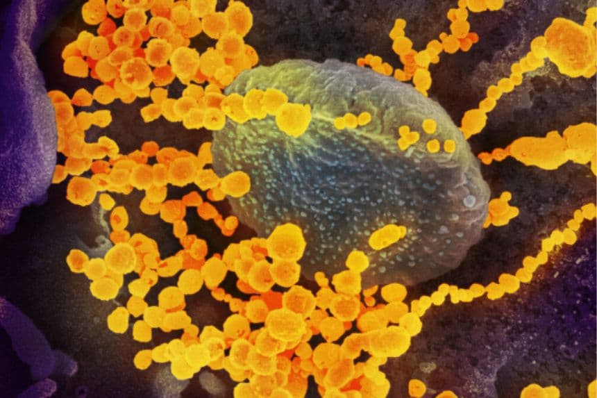 Una imagen de microscopio electrónico muestra el SARS-CoV-2 (objetos dorados redondos), causante del COVID-19, emergiendo de células cultivadas. (NIAID vía The Epoch Times)