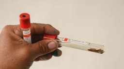 Aumentan casos de gusano barrenador en humanos, México registra más de una decena en diez días