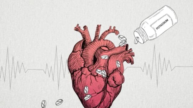 Aumentar el nivel de potasio protege a pacientes cardíacos
