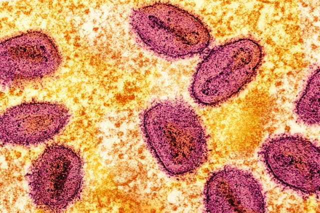 Autoridades advierten de posible propagación de cepa grave del virus Mpox en condado de Los Ángeles