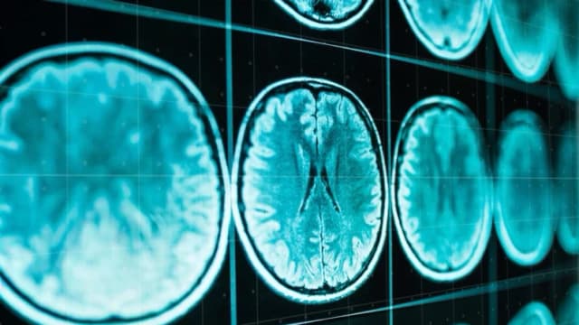 Imagen ilustrativa (Jalisko/Shutterstock)