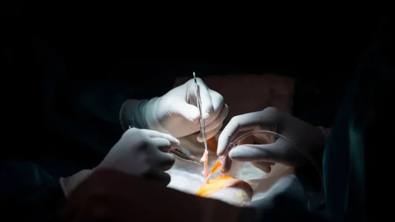 Trasplantes de riñón disminuyen mientras aumenta la supervisión de donación de órganos