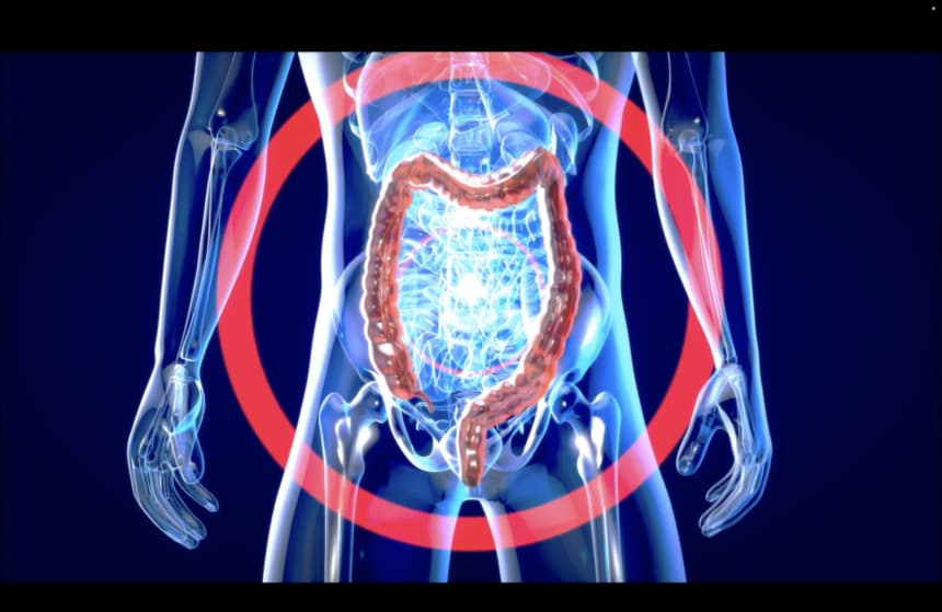 ¡Cuida tu metabolismo! si no funciona correctamente podría provocar una enfermedad crónica