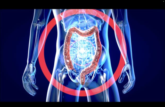 ¡Cuida tu metabolismo! si no funciona correctamente podría provocar una enfermedad crónica
