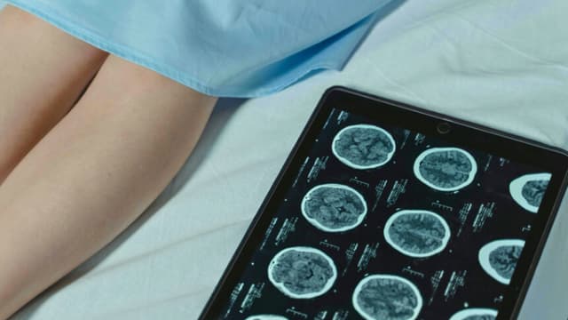 El cerebro tiene cinco "épocas importantes" a lo largo de la vida, según un estudio