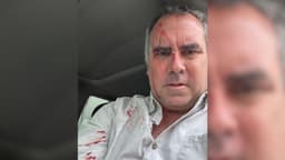 Precandidato presidencial peruano sobrevive a atentado tras ser tiroteado a bordo de su vehículo