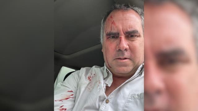 Fotografía tomada de la cuenta oficial @CostaGino de la red social X del excongresista de Perú, Gino Costa, donde se observa al precandidato a la Presidencia de Perú Rafael Belaúnde Llosa, después de sufrir un atentado en su contra este martes, en Lima, Perú. (EFE/@costagino)