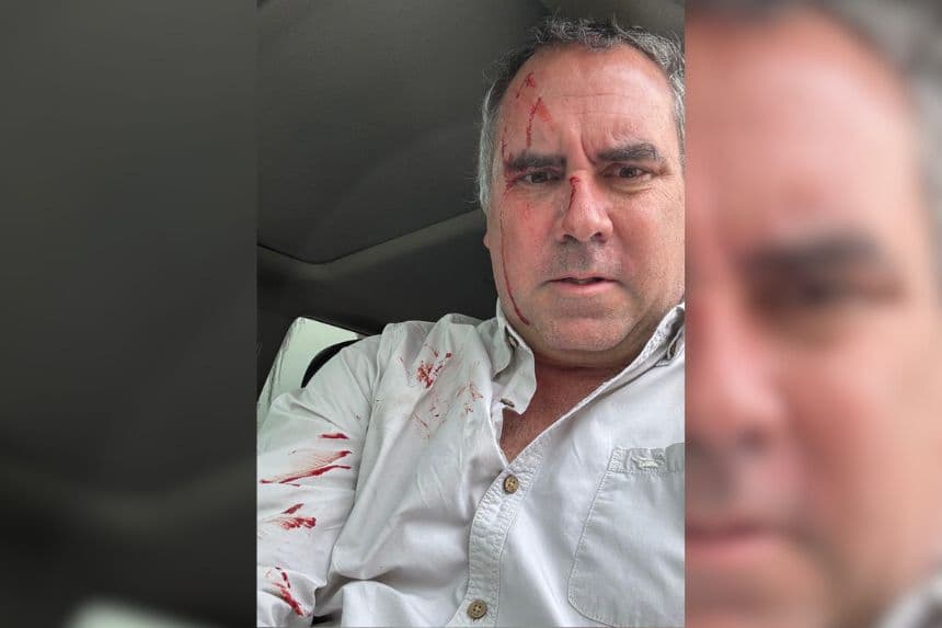 Precandidato presidencial peruano sobrevive a atentado tras ser tiroteado a bordo de su vehículo