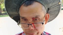 Una agresión deja ensangrentado a un practicante de Falun Gong, días después de una amenaza de bomba