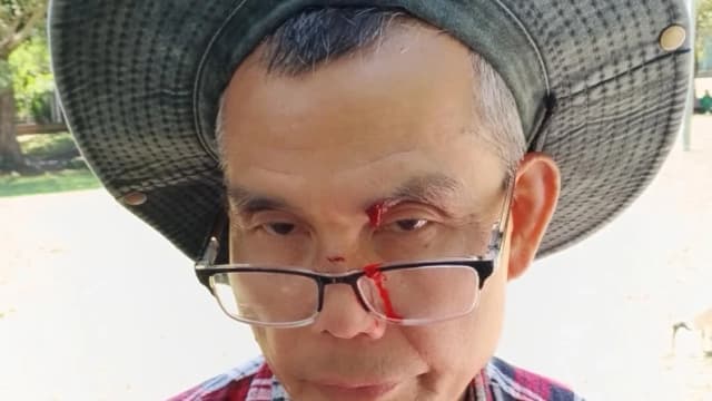 Kun Li, practicante de Falun Gong que fue golpeado con una botella vacía por Kane Hodges en Belmore Park, Sídney, el 2 de diciembre de 2025. (Cortesía de los practicantes de Falun Gong).