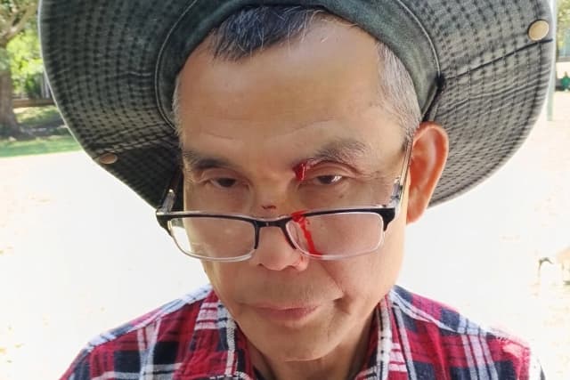 Una agresión deja ensangrentado a un practicante de Falun Gong, días después de una amenaza de bomba